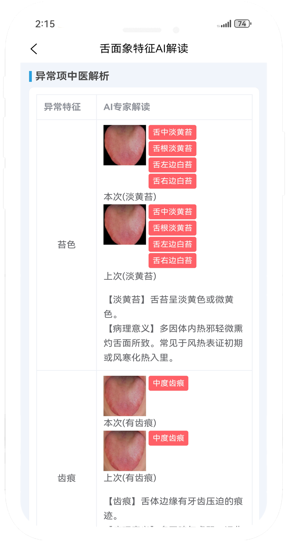 舌象特征解析.png