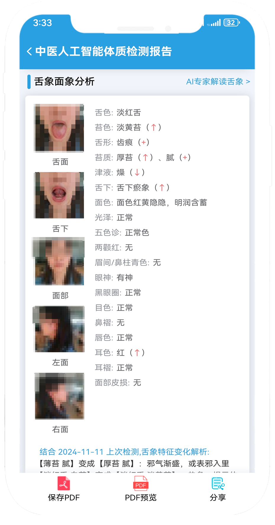 7舌面象智能分析.png