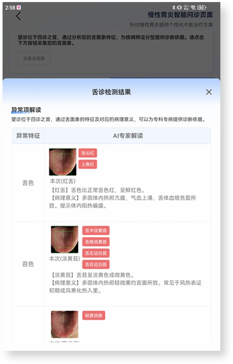 舌面象智能采集2.png