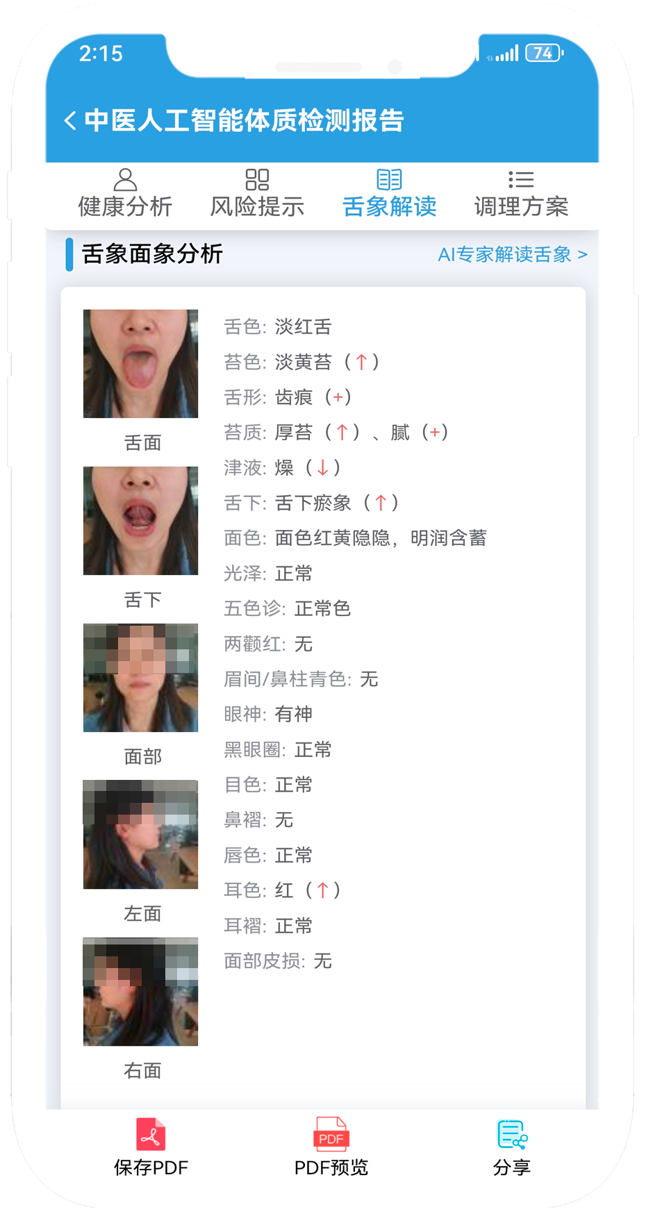 舌象特征辨识.png