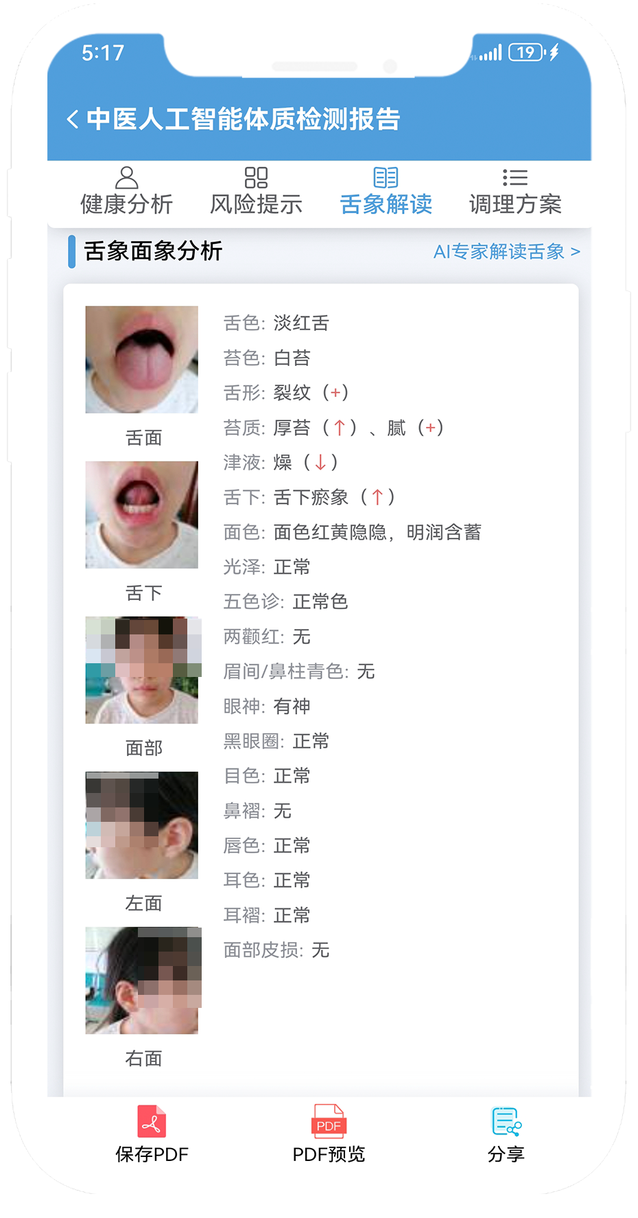舌象特征分析.png