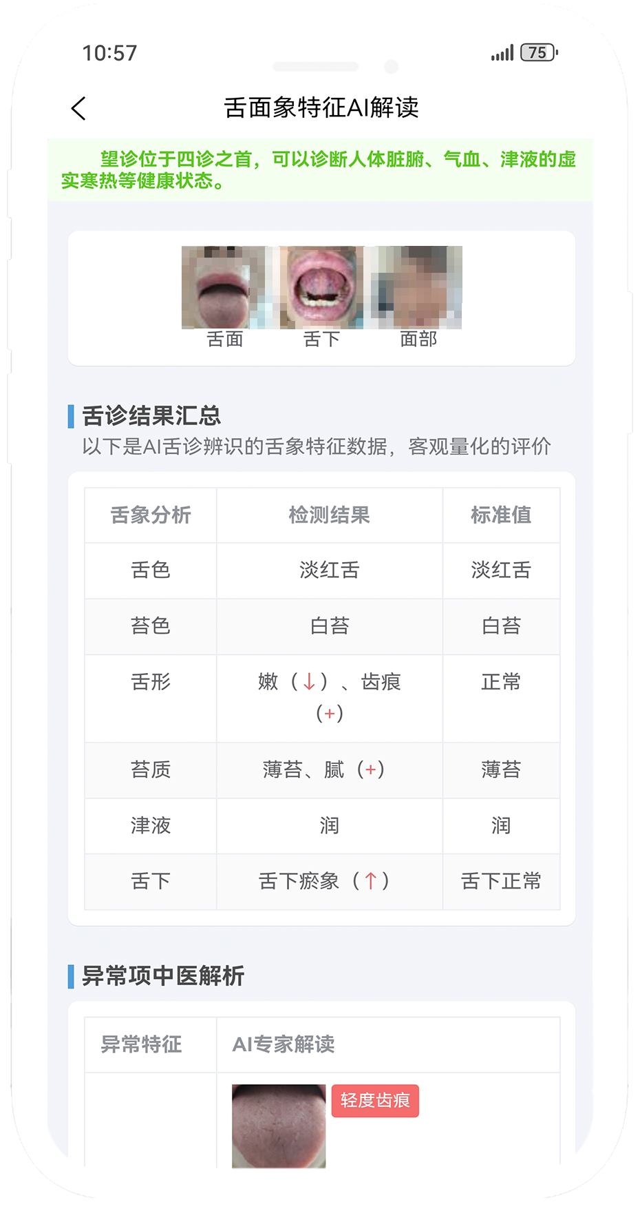 糖尿病中医分型与调理2.png