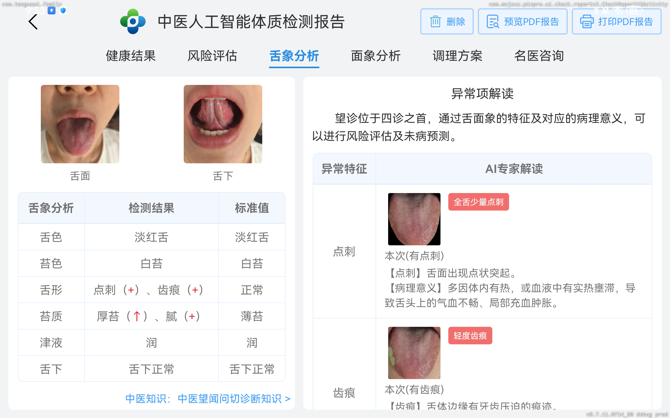 8舌象智能分析.jpg